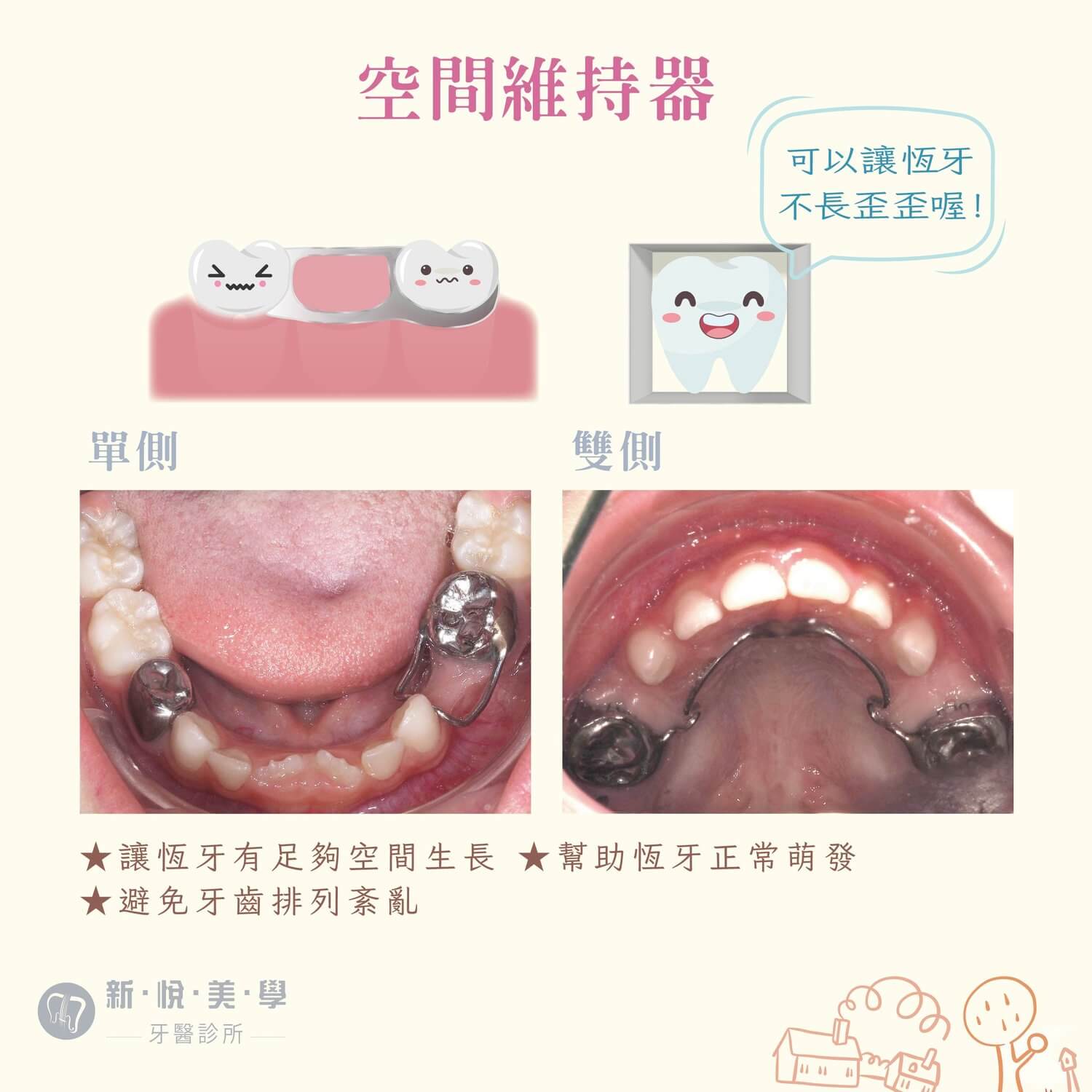 我們家寶貝有蛀牙怎麼辦?的第4張圖片